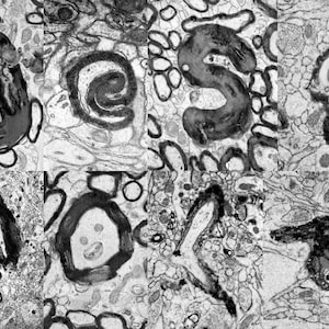 Può includere: Un'immagine microscopica in bianco e nero di una sezione trasversale del cervello umano. L'immagine mostra la struttura delle cellule e dei tessuti del cervello.