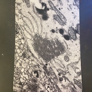Carte postale cardiaque de l'appareil de Golgi neurone, réticulum endoplasmique, biologie cellulaire, neurone, corps cellulaire, neurosciences, microscopie électronique