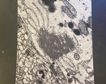 Neuron golgi apparatus heart postcard, endoplasmic reticulum, cell biology, neuron, cell body, neuroscience, electron microscopy