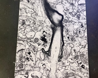 Candle burning in the brain postcard, electron microscopy of neurons, myelin axon, node of Ranvier, synaptic vesicles