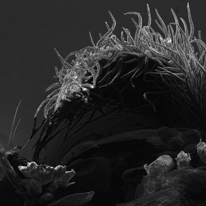 May include: A black and white close-up image of a plant with many thin, hair-like structures. The structures are densely packed together and appear to be growing from a central point. The image is taken with a scanning electron microscope.