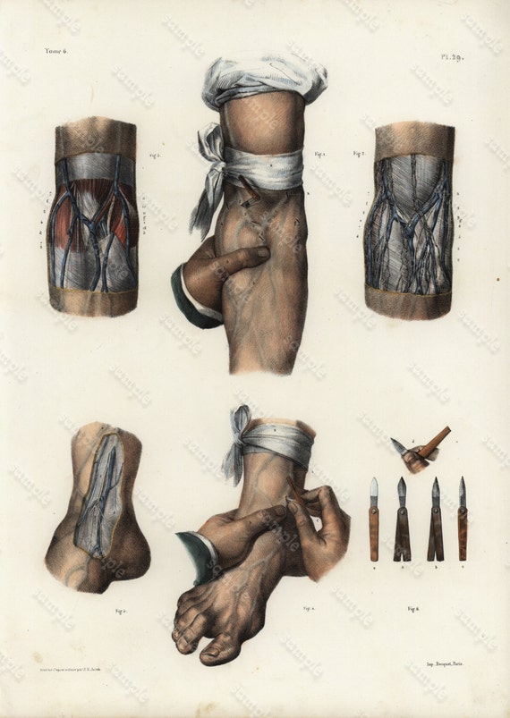 Original Antique colored Lithograph Human anatomy Gorgeous Engraving 1860-1870 -  Large Folio - medical Human Muscles hands- Tendons