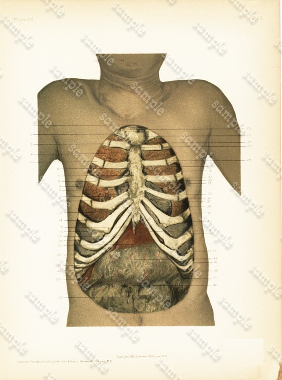 Original Antique Colored Lithograph of Human Anatomy - Human Ribs and Torso gorgeous Detailed