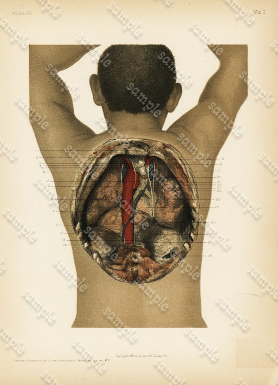 Original Antique Colored Lithograph of Human Anatomy - Human Back and Lungs  gorgeous Detailed