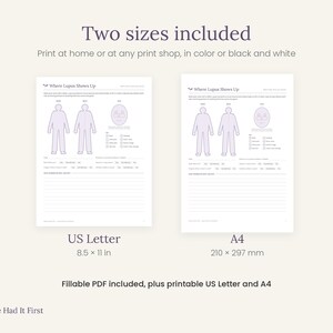 以下が含まれることがあります： 「Where Lupus Shows Up」と題された2種類の印刷可能な健康追跡フォーム。人体と顔の図に症状のチェックボックスが記載されています。8.5 x 11インチのUSレターサイズと、210 x 297 mmのA4サイズで提供されています。