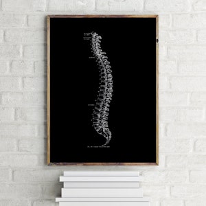 Vintage Lateral Spine Osteology Vertebrae Spinal Surgeon Chiropractor Human Anatomy Art Print Black