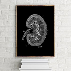 Kidney Urology Nephrology Human Anatomy Art Print Dialysis Medical Drawing Vintage Anatomical Model Black