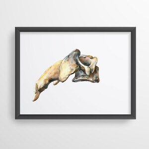 Cervical Vertebra Spine Human Anatomy Watercolor Art Print