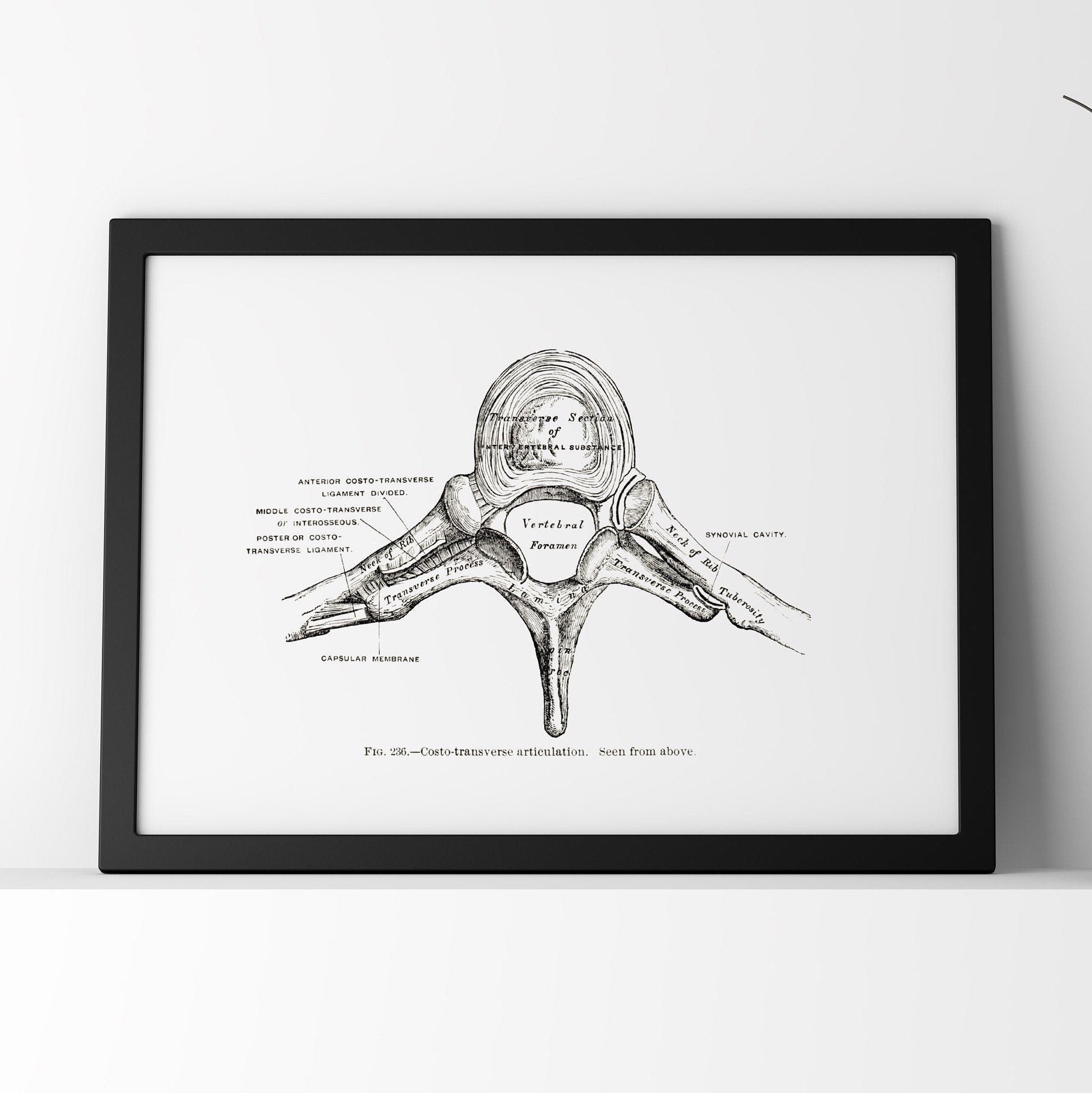 Vertebra Costotransverse Articulation Spine Vintage Osteology Etsy