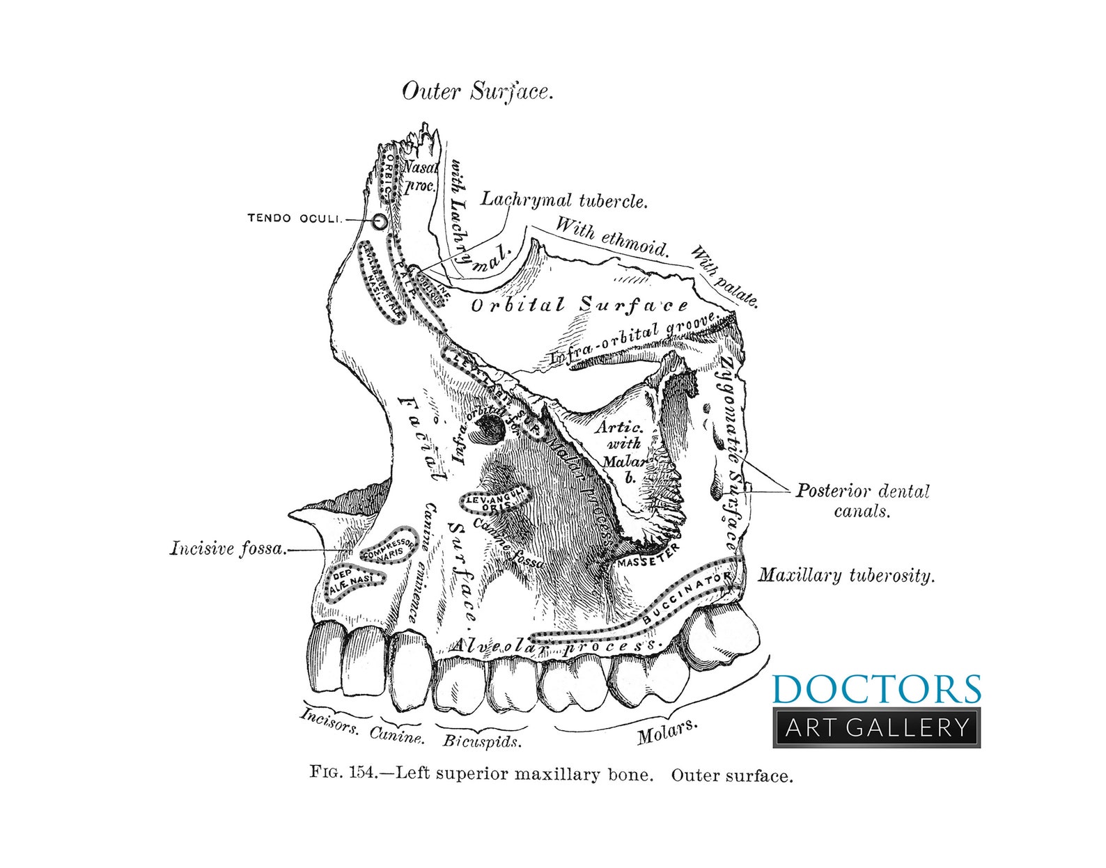 Maxillary Bone Superior Dental Orthodontic Maxillofacial Oral Etsy