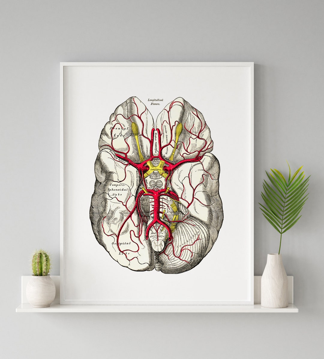 Brain Arteries Temporal Lobe Occipital Lobe Frontal Lobe Longitudinal