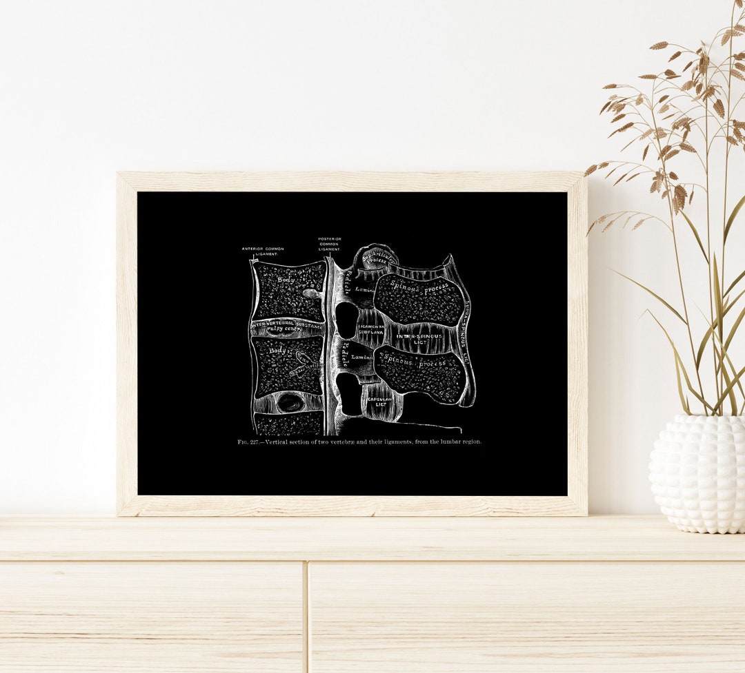 Vintage Spine Lumbar Vertebrae Ligaments Osteology Human Anatomy Art ...
