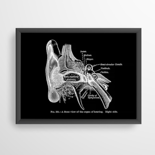 Ear Canal Cochlea Hearing Vestibule Incus Malleus Stapes Osseous Cavity of Tympanum Dark Vintage Audiology ENT Anatomy Art Print X-Ray Black