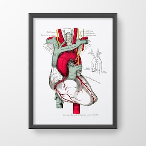 Heart Aorta Cardiology Human Anatomy Art Print Vintage Medical Drawing
