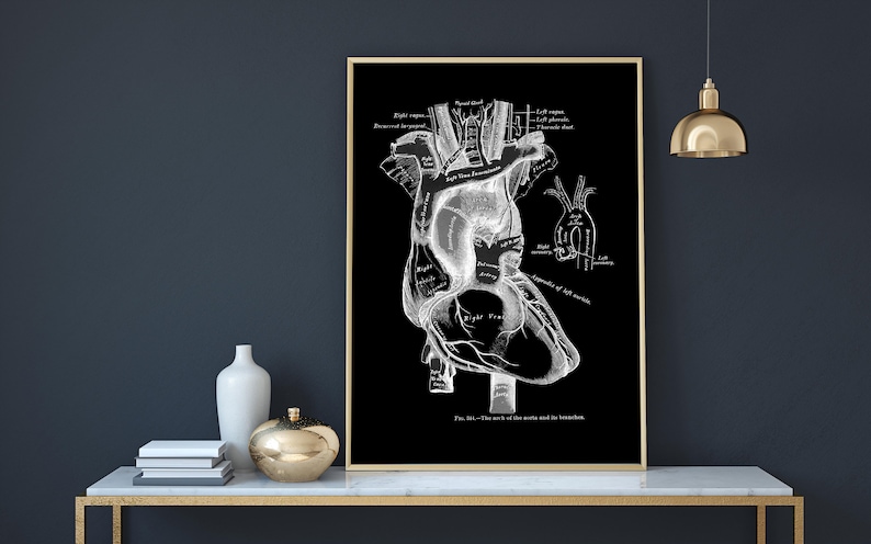 Heart Aorta Cardiology Vintage Human Anatomy Art Print X-ray - Etsy