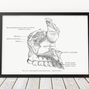Maxillary Bone Dental Orthodontic Maxillofacial Oral Surgery Vintage Anatomy Art Print