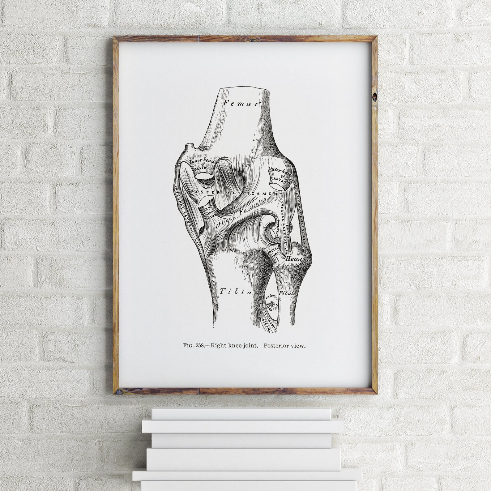 Knee Joint Posterior Ligament Oblique Fasciculus Tibia Fibula - Etsy