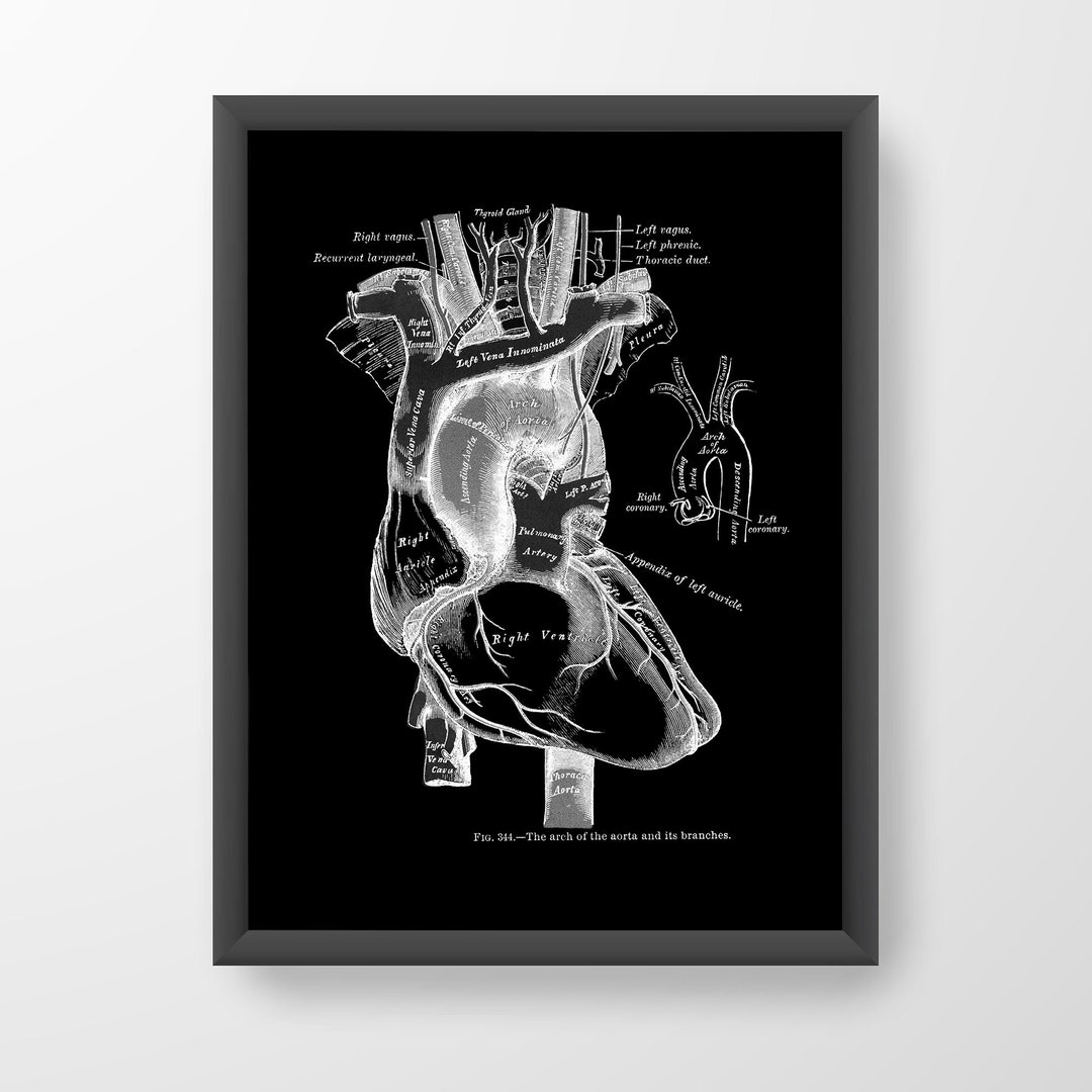 Heart Aorta Cardiology Vintage Human Anatomy Art Print X-ray Black - Etsy