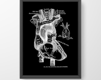 Heart Aorta Cardiology Vintage Human Anatomy Art Print X-Ray Black