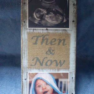 May include: A wooden picture frame with two photos. The top photo is a black and white ultrasound image. The bottom photo is a color photo of a baby in a blue towel. The frame has a burlap background with the words "Then & Now" printed on it.