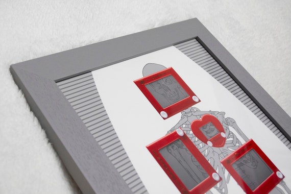 Skeleton Etch A Sketch Art Series 10x20 Print