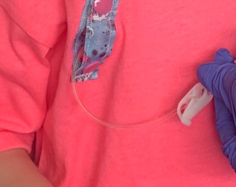 May include: A pink t-shirt with a blue and white patterned ribbon sewn down the front. The ribbon has pink buttons attached to it. A clear medical tube is attached to the ribbon and is connected to a white medical device.