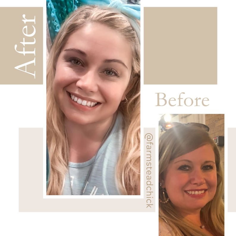 May include: Before and after photos of a woman smiling. The before photo shows the woman with a larger face and a double chin. The after photo shows the woman with a slimmer face and a more defined jawline. The text "@farmsteadchick" is written vertically on the right side of the image.