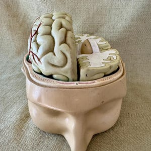 May include: An anatomical model of a human head with the top portion of the skull removed to reveal a detailed brain model. The brain is light green with red vascular markings, and the skull base is a light beige color with the letter B visible.