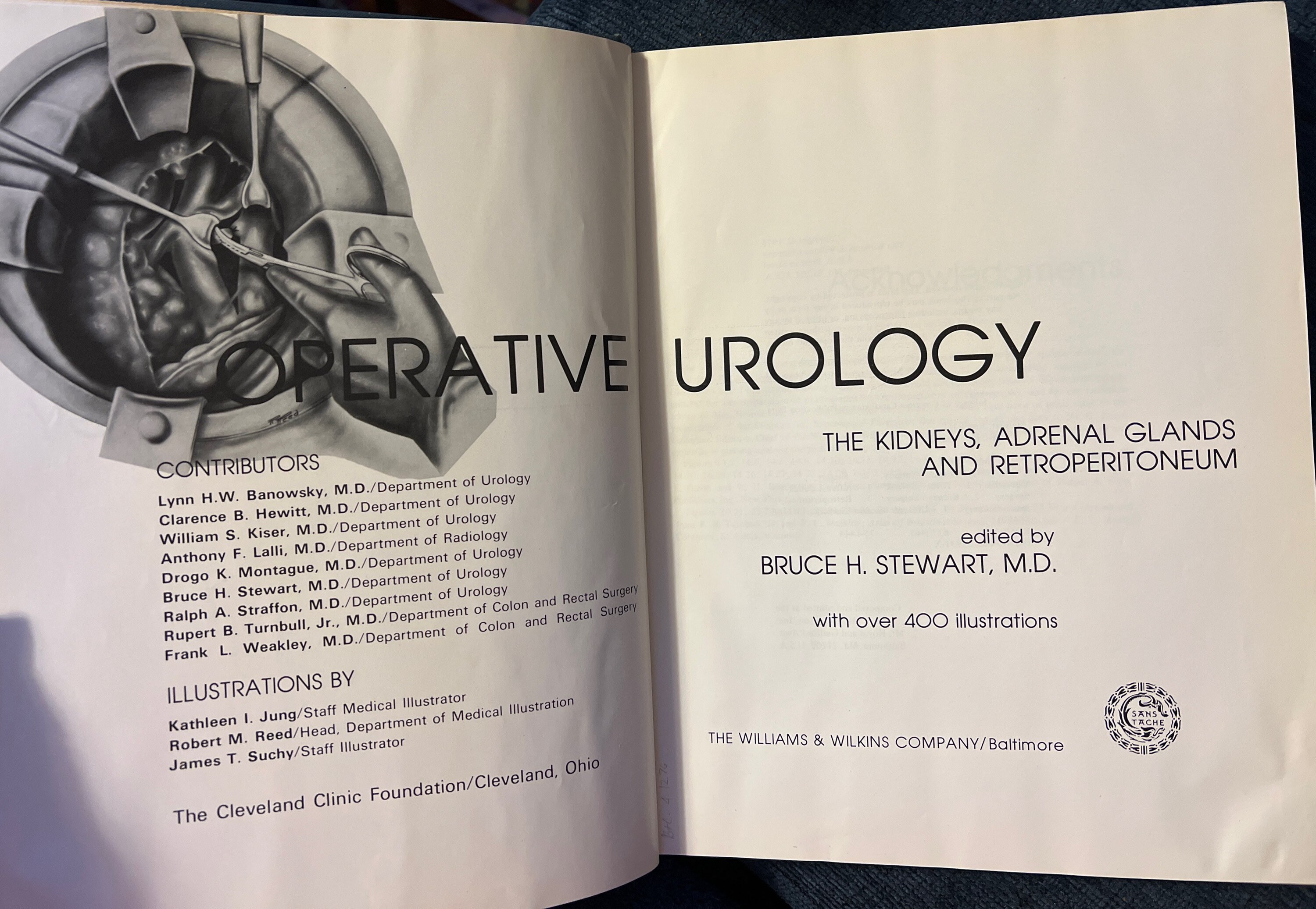 STEWART'S OPERATIVE UROLOGY Volume One