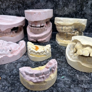 Dental Molds - Casts - Impressions - Dentistry - Oddities - Teeth - Curiosity - Apothecary - Halloween - Collectibles - WRSHF2
