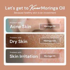 May include: A graphic showing how moringa oil can help with acne, dry skin, and skin irritation. The graphic features close-up images of skin with the text "Problem with" and the skin condition listed, followed by a button that says "Moringa Oil".