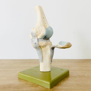 Vintage Knee Medical Anatomical Model by Somso West Germany