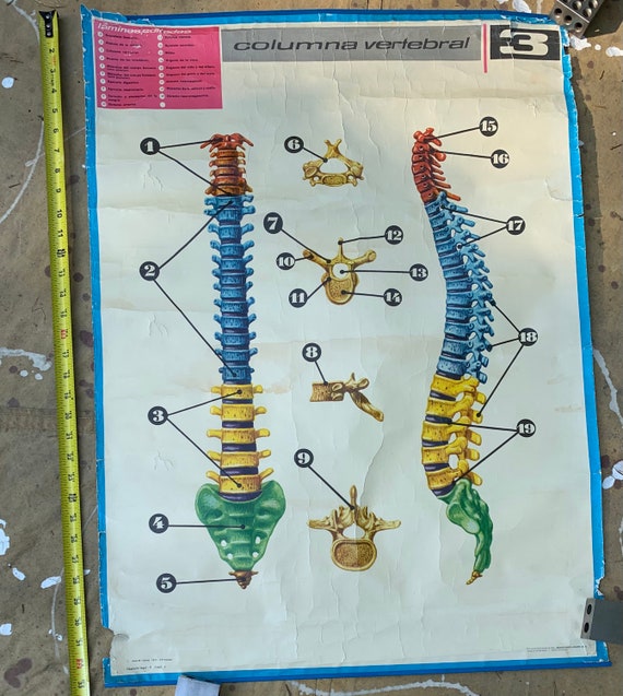 1971 medical chart from Barcelona Spain spine bone