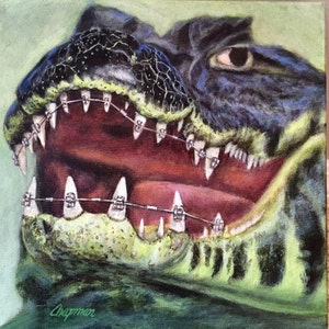 Gator grin. Smiling Alligator with Mouth Full of Braces. Great for Dentist Office.Artist signed print.