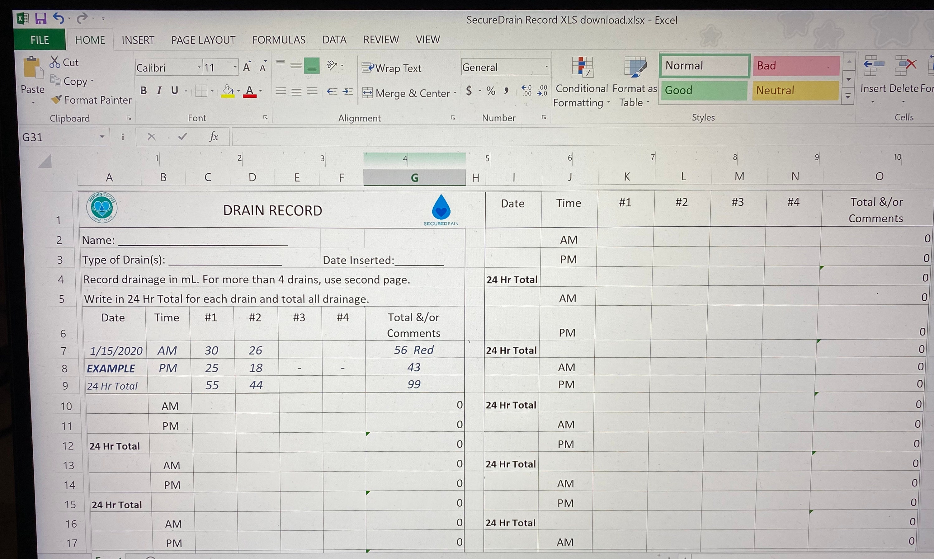 JP Drain Record Form. Post Mastectomy Drain Care, Record JP Drainage ...