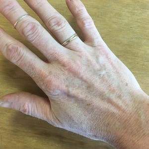 May include: Close-up of a hand with two thin rings on the fingers. The skin has a light tone with visible veins and freckles. The background is a light brown wooden surface.