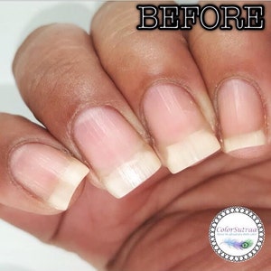 Op de afbeelding: Close-up van een hand met ongelakte nagels. De nagels hebben een natuurlijke roze kleur met witte punten. Het woord "BEFORE" staat bovenaan de afbeelding. Het ColorSutraa-logo staat rechtsonder.