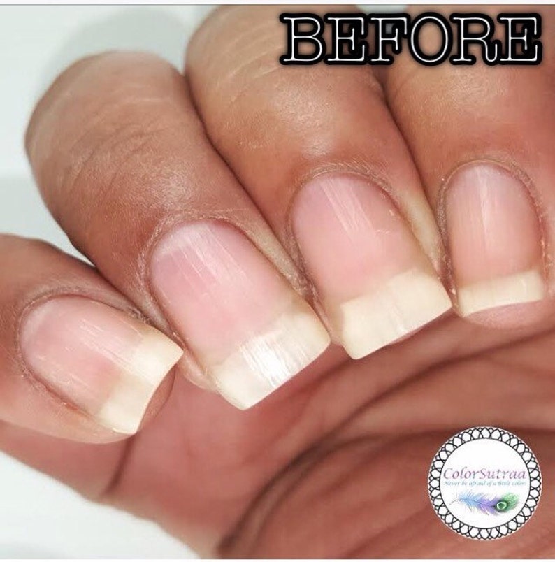 Op de afbeelding: Close-up van een hand met ongelakte nagels. De nagels hebben een natuurlijke roze kleur met witte punten. Het woord "BEFORE" staat bovenaan de afbeelding. Het ColorSutraa-logo staat rechtsonder.