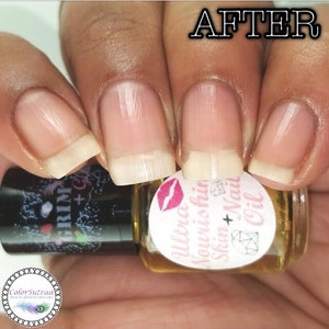 Op de afbeelding: Close-up van nagels na het aanbrengen van Ultra Nourishing Skin + Nail Oil. De nagels zien er schoon en gezond uit. Een klein flesje olie is zichtbaar, met een label met een roze lipdesign en de productnaam. Het woord "AFTER" staat rechtsboven.