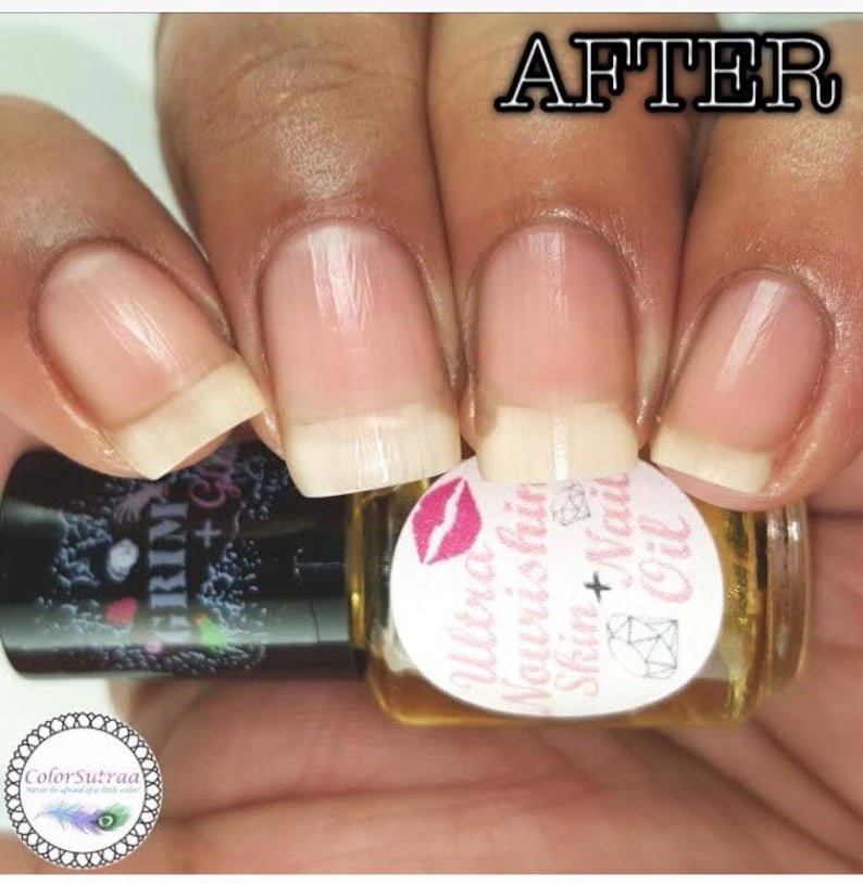 Op de afbeelding: Close-up van nagels na het aanbrengen van Ultra Nourishing Skin + Nail Oil. De nagels zien er schoon en gezond uit. Een klein flesje olie is zichtbaar, met een label met een roze lipdesign en de productnaam. Het woord "AFTER" staat rechtsboven.