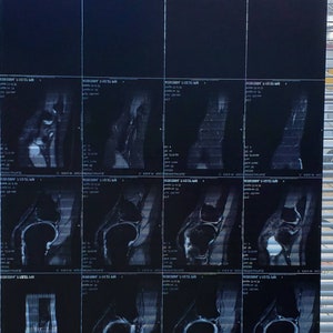 NOW 50% OFF Spooky x-rays