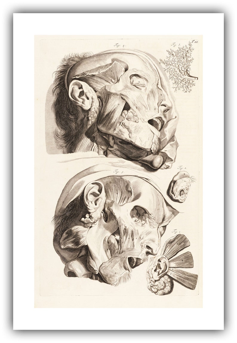 Govard Bidloo and Gerard De Laireese : Flayed Human Head (anatomia ...