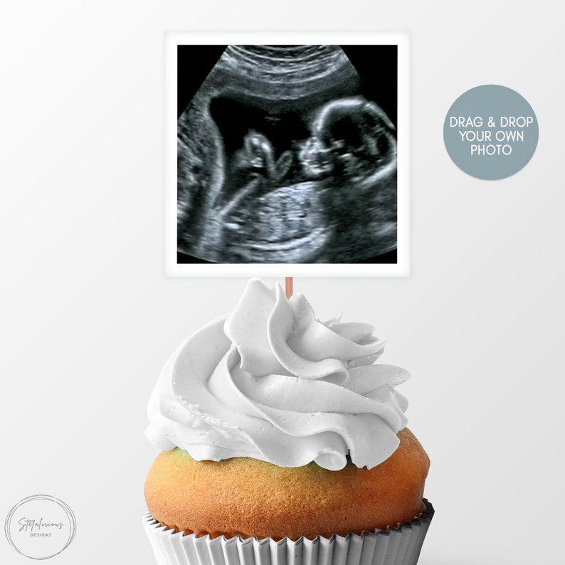 Baby Shower Cupcake Toppers, Custom Photo Sonogram Cupcake Topper for