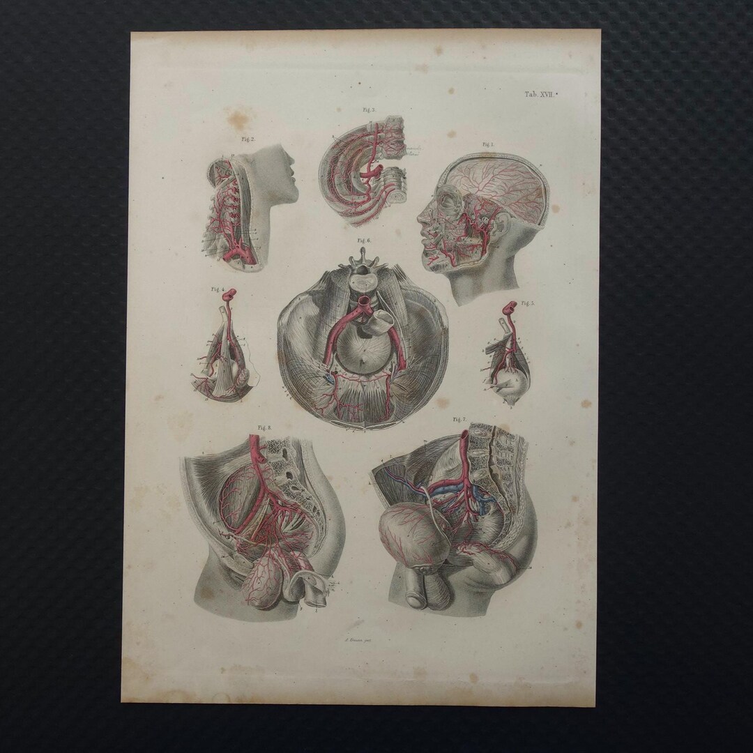 Old Anatomy Print of Blood Vessels in the Head Neck and Pelvis 1871 ...