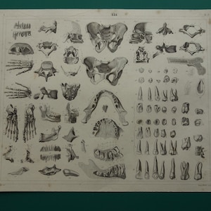 TEETH antique anatomy print 1849 old anatomical poster with pictures of tooth grinder jaw jaws dental illustration - vintage prints 9x11