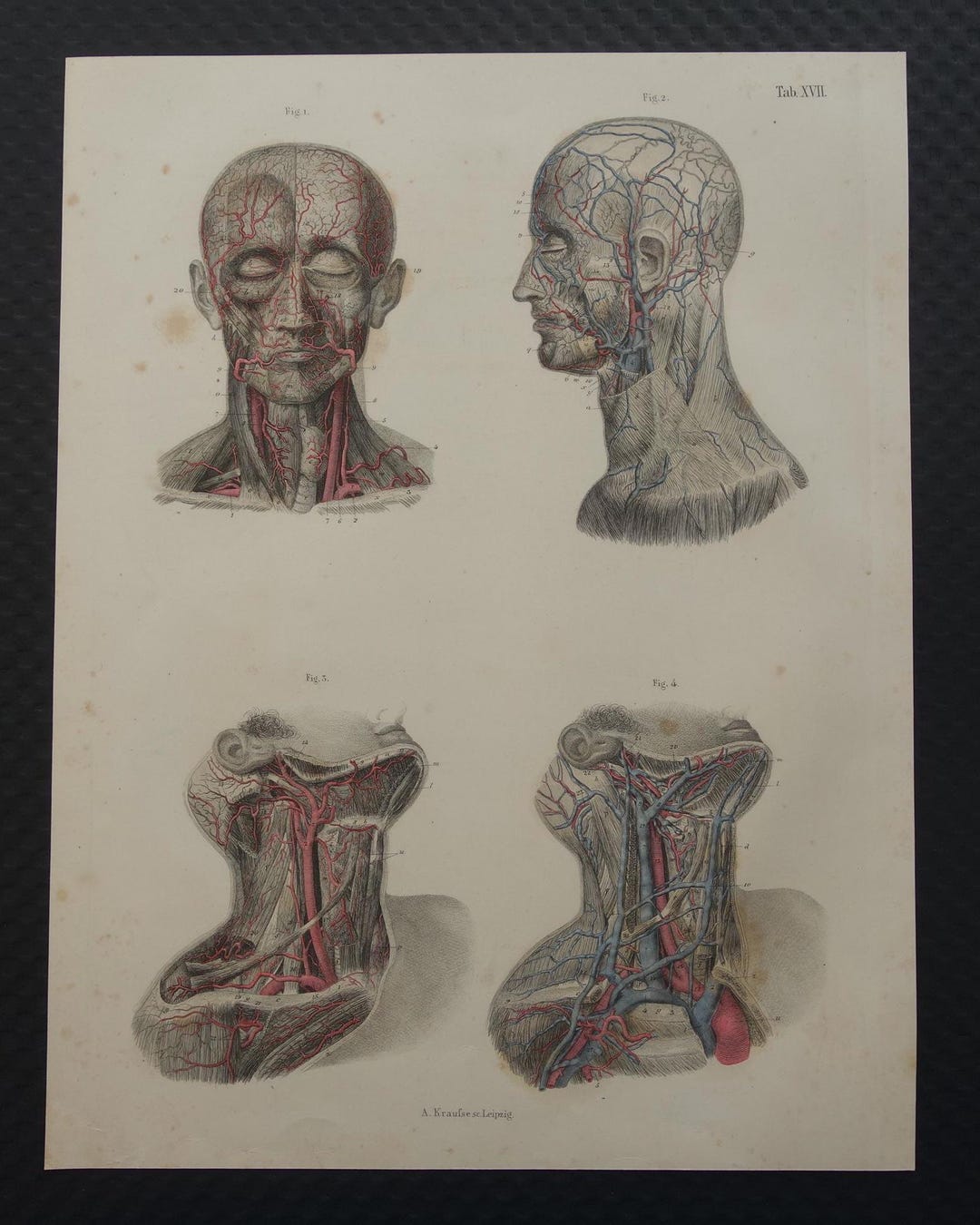 Old Anatomy Print of Blood Vessels in the Head and Neck 1871 Original ...