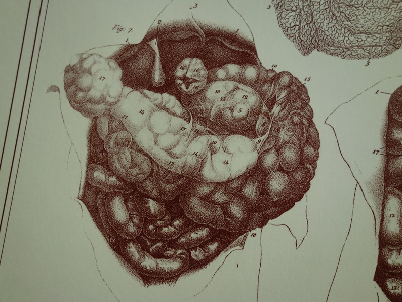 vintage poster with pictures about gallbladder omentum epiploon intestines 9x12 22x30c re Anatomy print of old antique anatomical plate