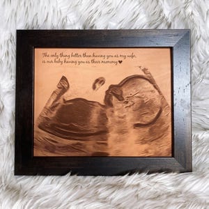 Ultrasound Photo Engraved on Leather - Custom Baby Sonogram Gift for New Parents & Nursery Decor | JW Design Studio
