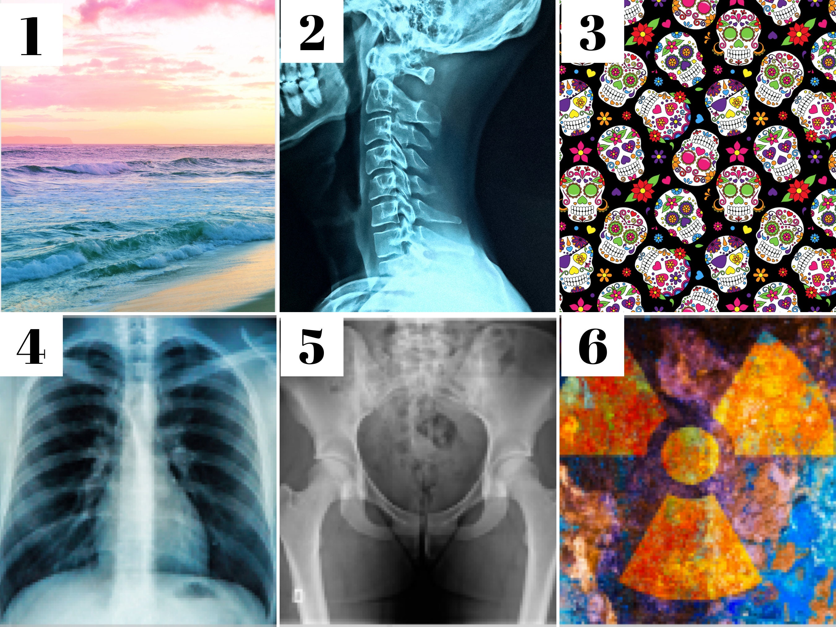 Xray marker holder Badge reel holder. A black retractable Etsy