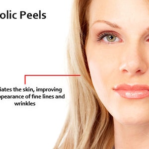 GLYCOLIC ACID Chemical Peel Kit Revitalize Your Skin Natural Exfoliating Treatment An Alpha Hydroxy Acid image 3